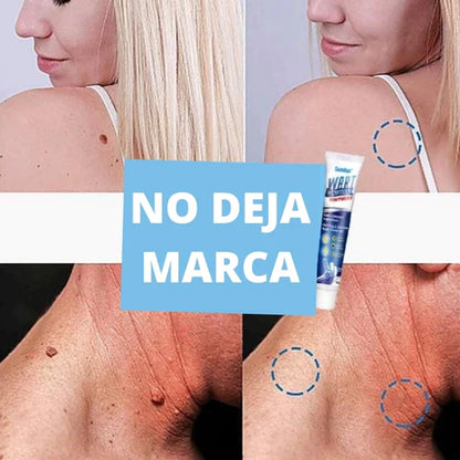 Wart Remover - Renovedor de verrugas T